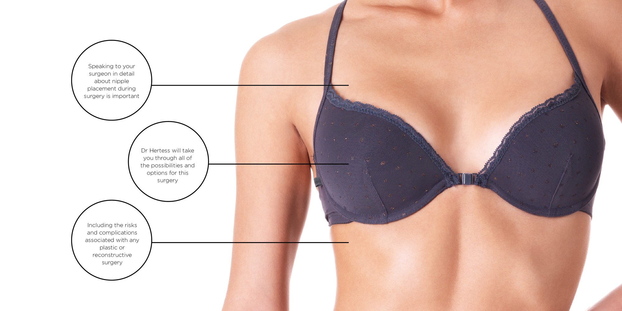 Nipple Reduction with Breast Reduction