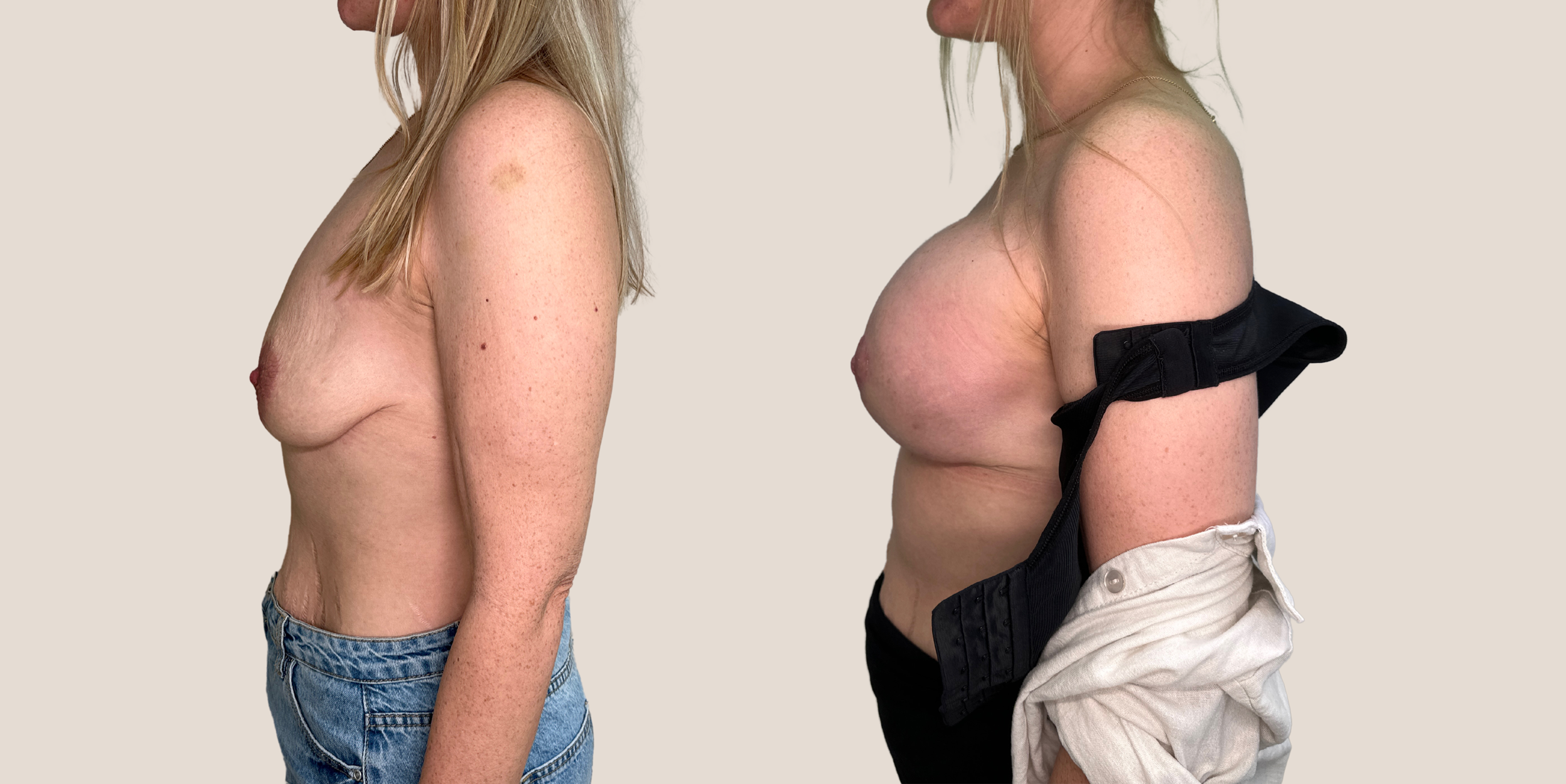 GalaFLEX_Internal_Bra_3