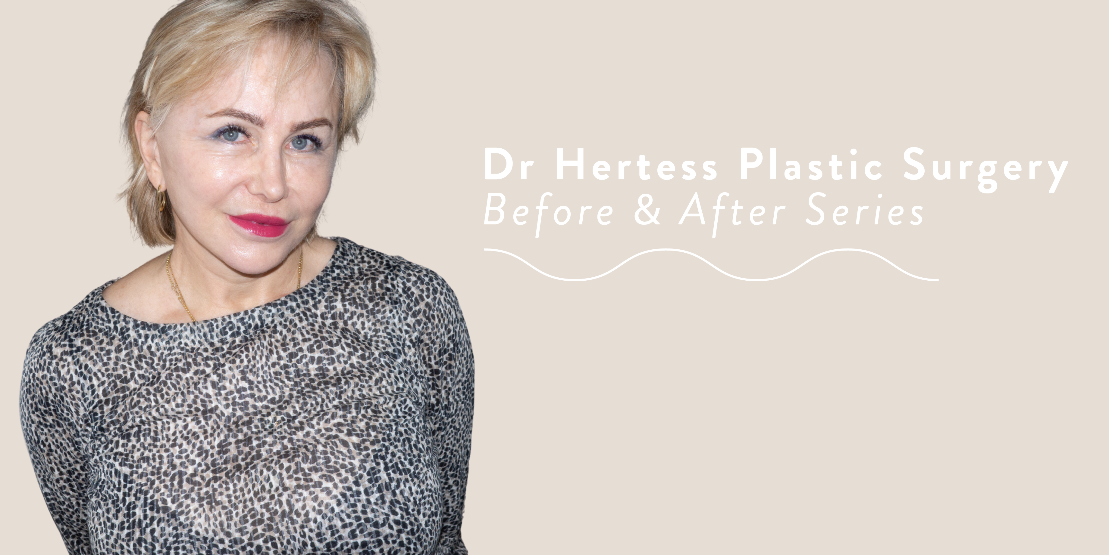 Dr Hertess Plastic Surgery Before & After Series
