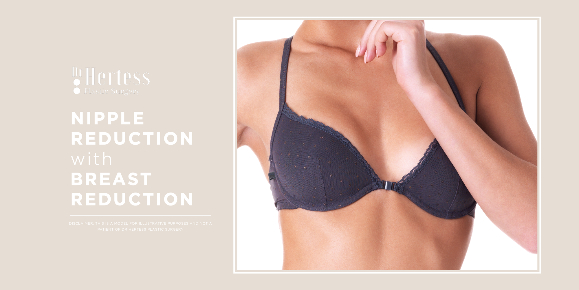 Nipple reduction with breast reduction
