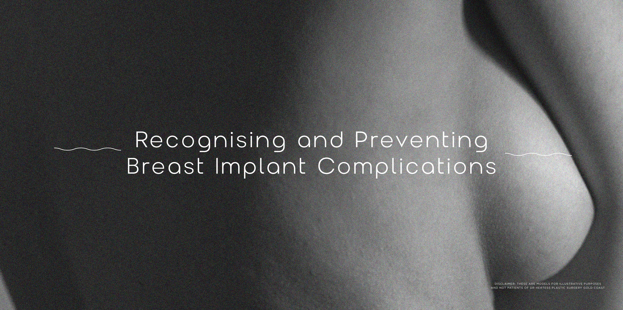 Recognising and Preventing Breast Implant Complications