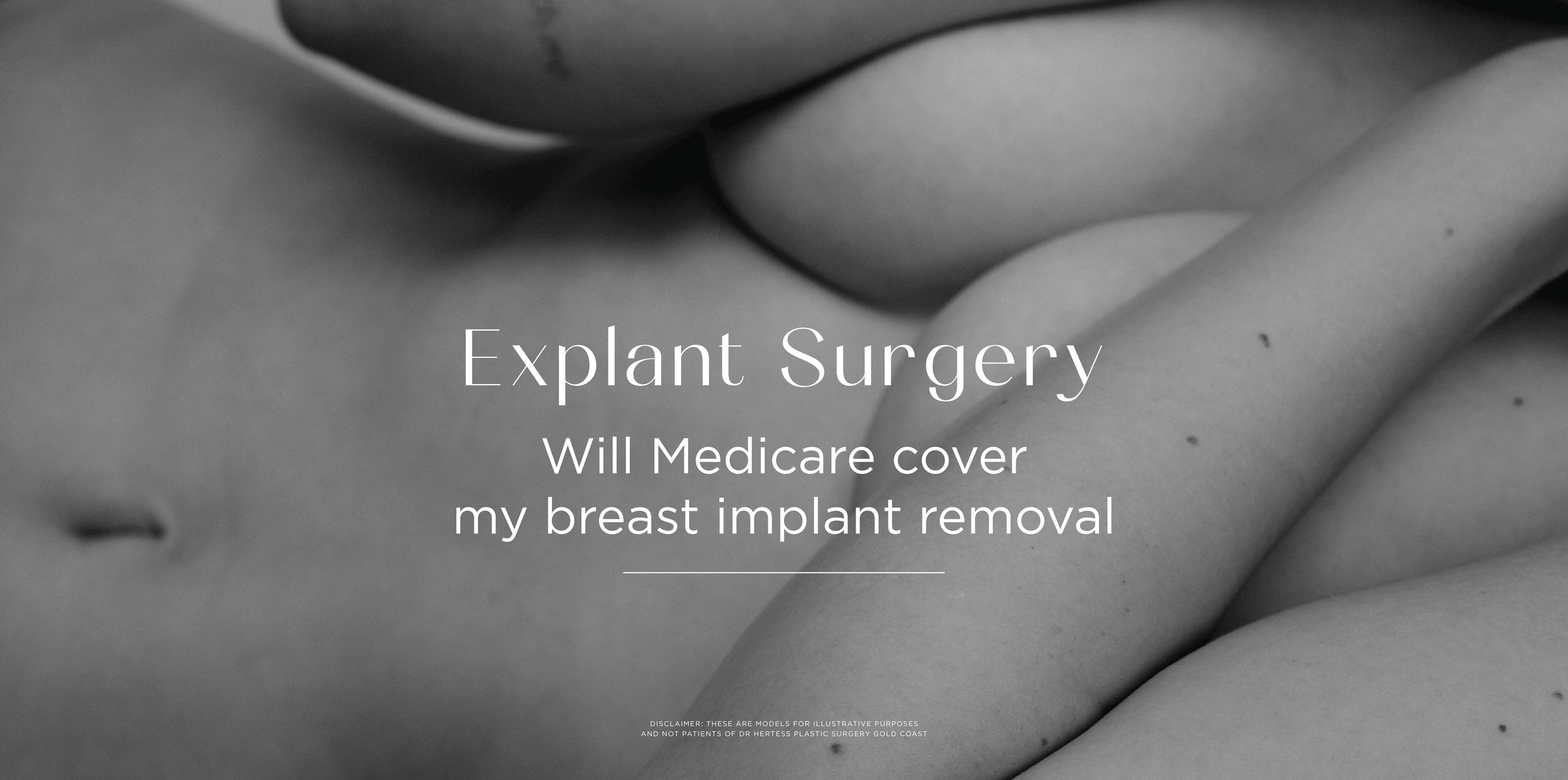 Will Medicare cover my implant removal?