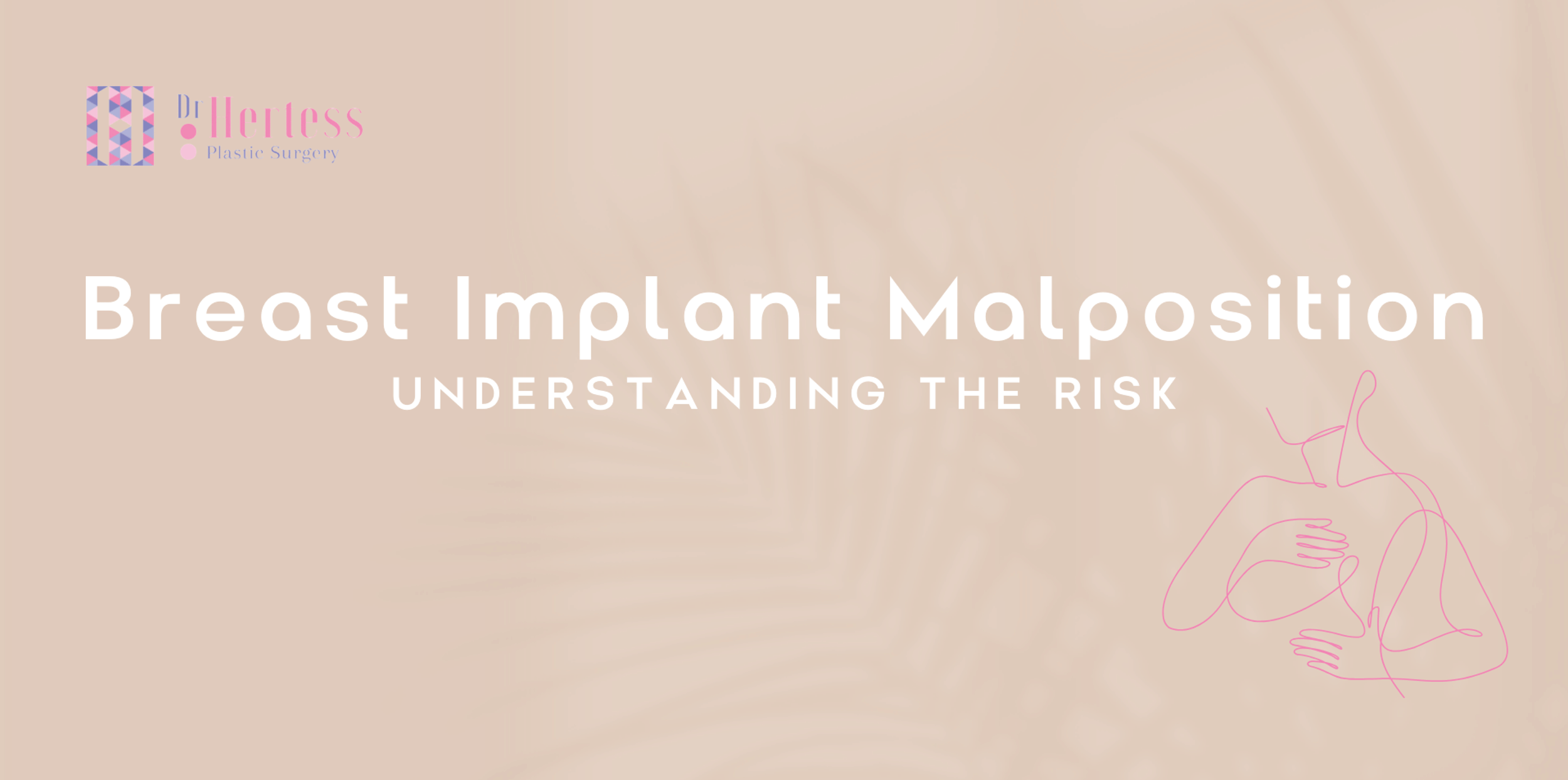 Breast Implant Malposition: Understanding the Risk